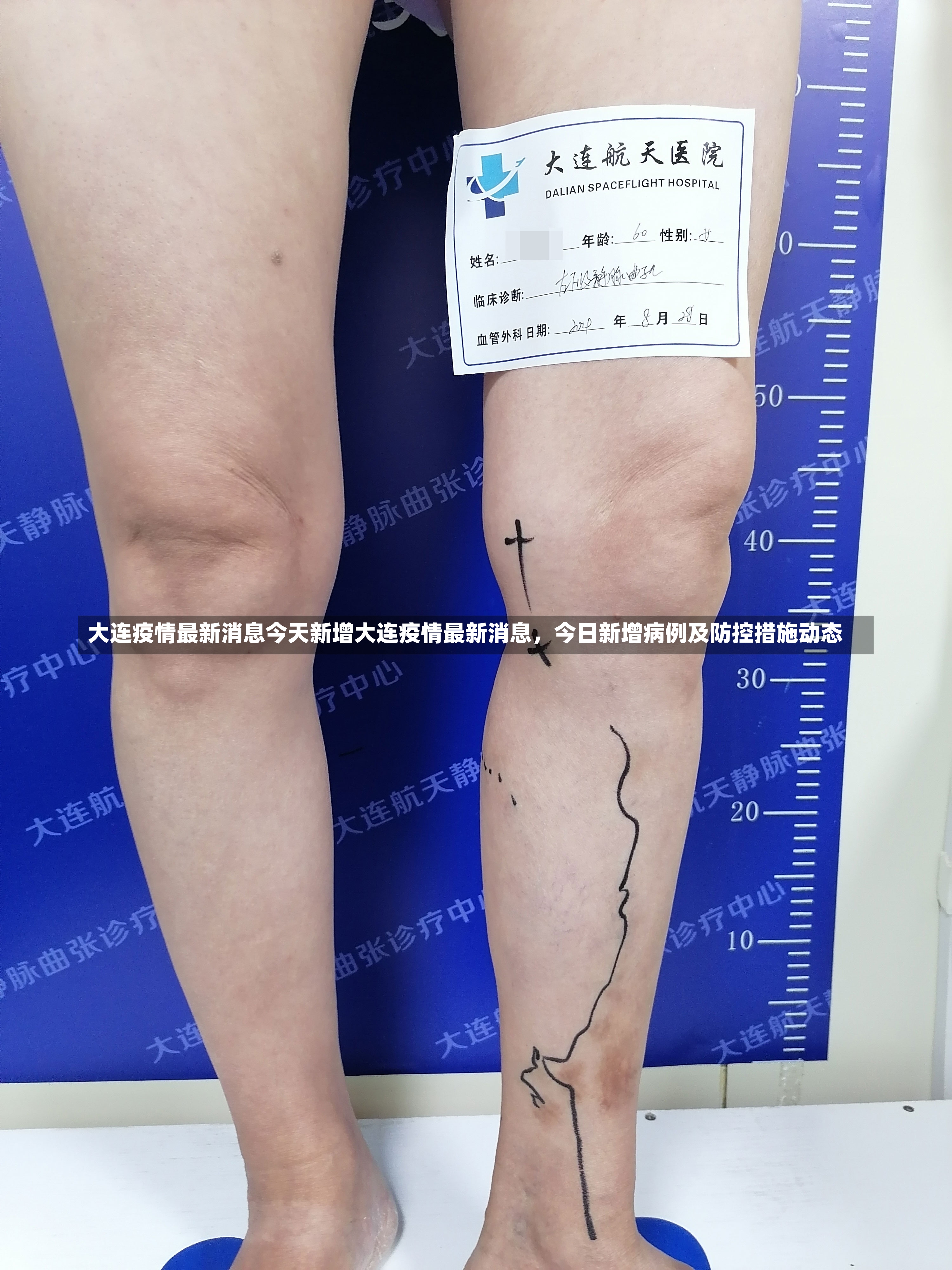 大连疫情最新消息今天新增大连疫情最新消息，今日新增病例及防控措施动态-第2张图片-通任唐游戏